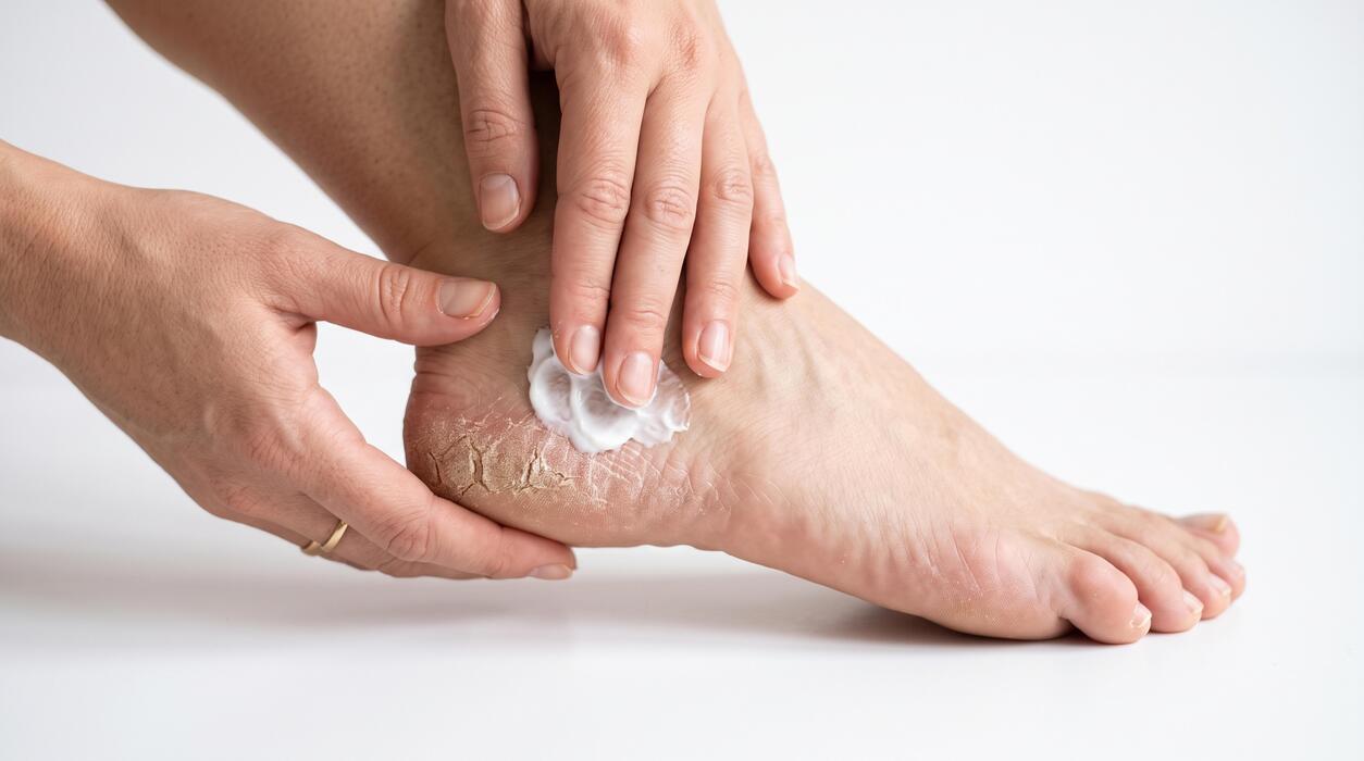 What is the strongest natural pain reliever - Hands applying moisturizing cream to severely dry cracked heel isolated on white